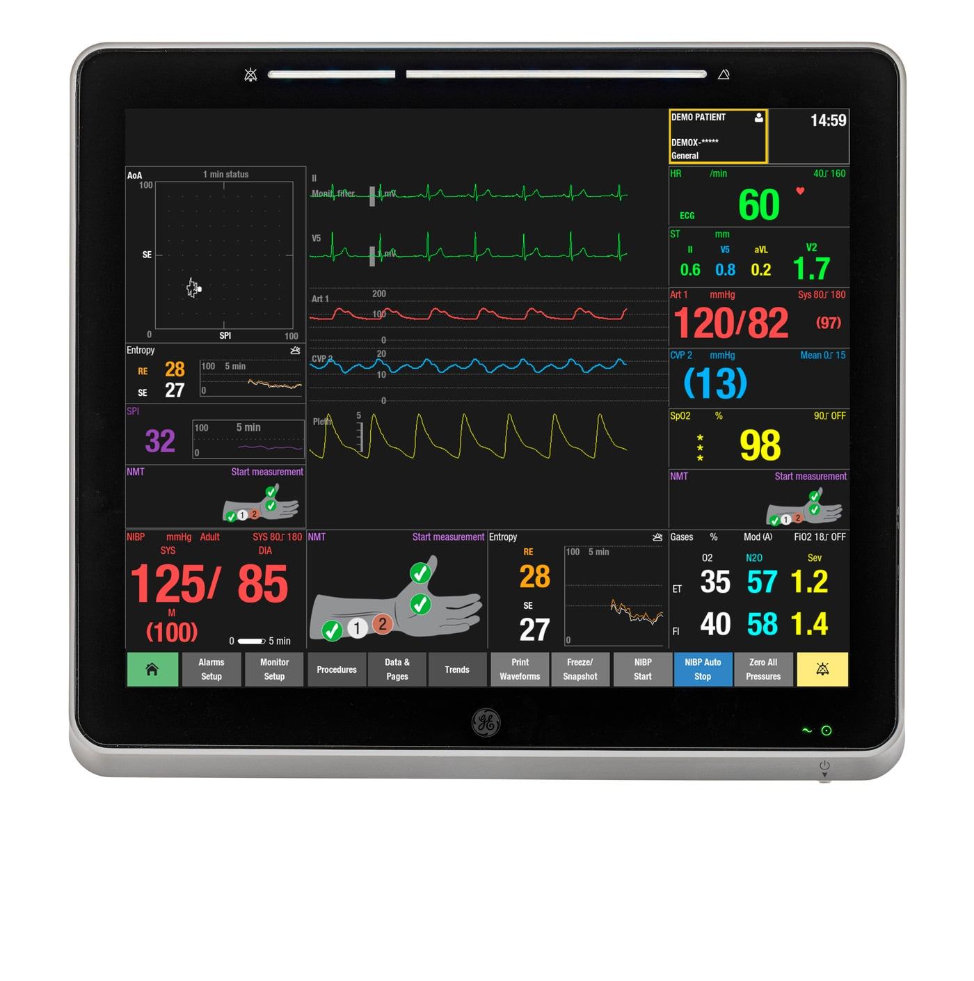 Courtesy of GE HealthCare