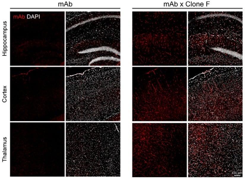 The appearance of administering existing substances that fail to cross the blood-brain barrier (BBB), showing almost no red signal (left), and the appearance confirming substance delivery after applying Grabody-B (Provided by ABL Bio) / News1