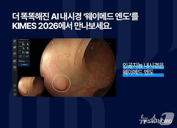 Waycen will unveil its advanced AI endoscope, Waymed Endo, at KIMES 2026, which takes place on March 19 / Provided by Waycen