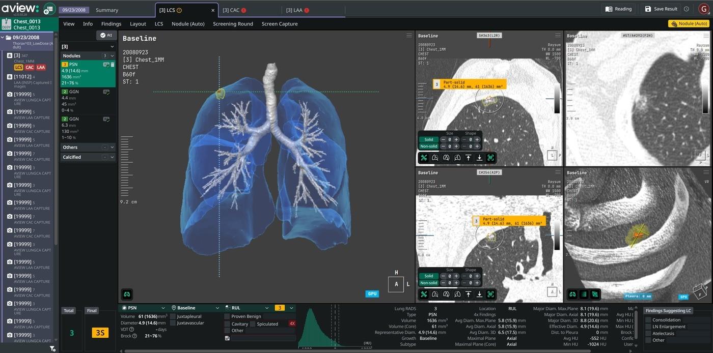 CorelineSoft's eView LCS Plus / Provided by Coreline Soft