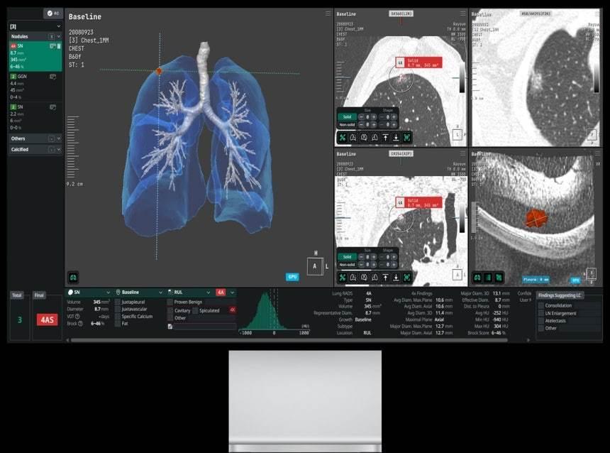 CorelineSoft's solution AVIEW / Provided by Coreline Soft