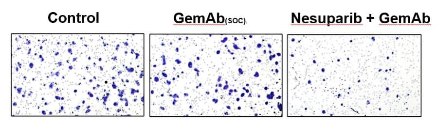 Inhibition of pancreatic cancer cell metastasis by Nesuparib / Provided by Jeil Pharmaceutical