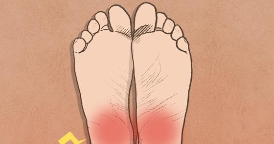 She Lost 2kg in a Week — Then Couldn’t Walk: Truth About Runner’s Heel Pain