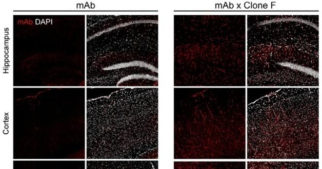 How ABL Bio's Grabody-B Revolutionizes siRNA Delivery: A Game-Changer for Brain Disease Treatment?