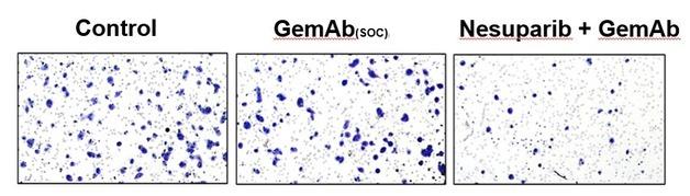 Nesuparib: The Revolutionary Dual-Inhibitor for Pancreatic Cancer – Can It Outperform Existing Treatments?
