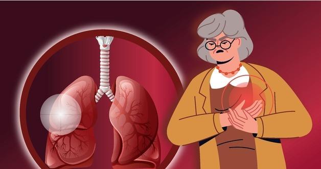 Is Winrevair the Future of PAH Treatment? Discover Its Unique Mechanism and Benefits